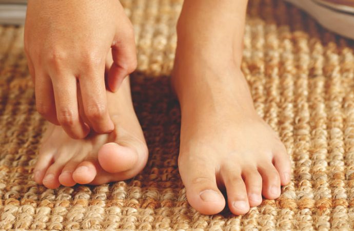 Exodermin: la crema efficace per il trattamento del piede d’atleta