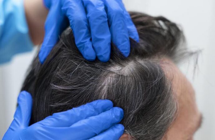 Dr Gary Roberts – Pillole per la crescita dei capelli: Funzionano davvero?